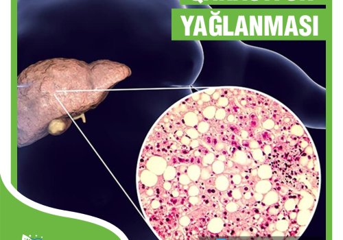 QARACIYER YAGLANMASI